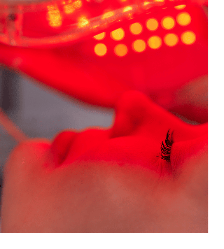 Photodynamic Therapy Ann Arbor, MI Ganger